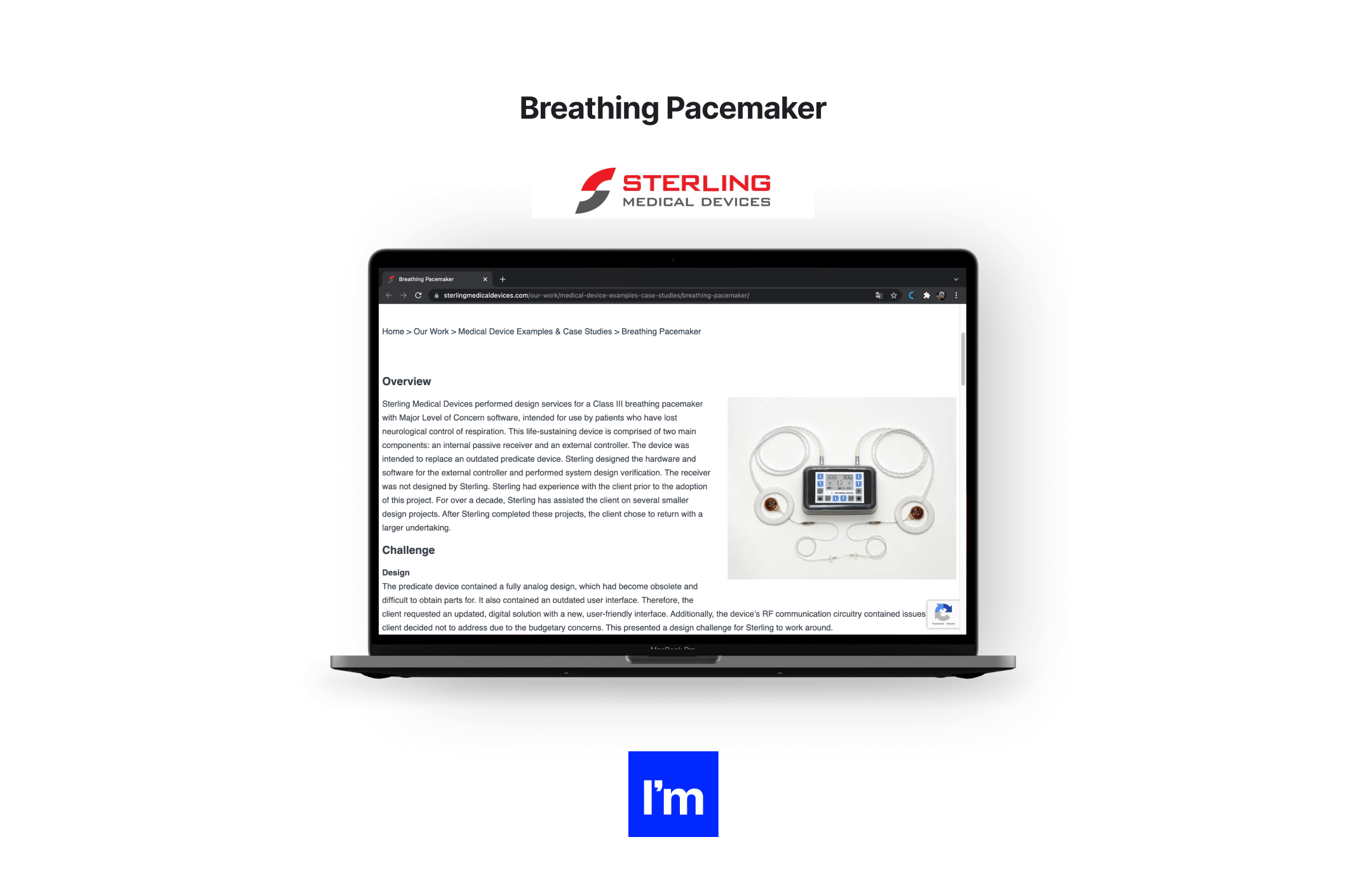 20 przykładów produktów MedTech - breathing pacemaker